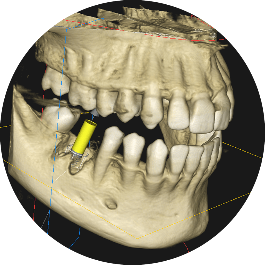 dental xray