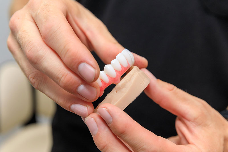 dr. diehl holding full mouth dental; implants